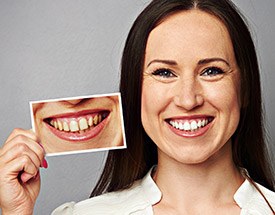 Woman holdin photo of smile before teeth whitening