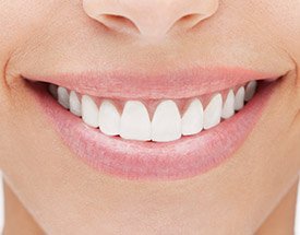 Closeup of smile with healthy teeth and gums