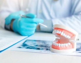 Model of teeth lying on desk next to dentist, X-rays, and paperwork