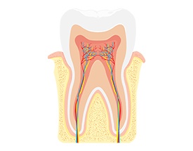 Animatino of the inisde of the tooth