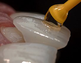 woman smiling after getting veneers in Canton 